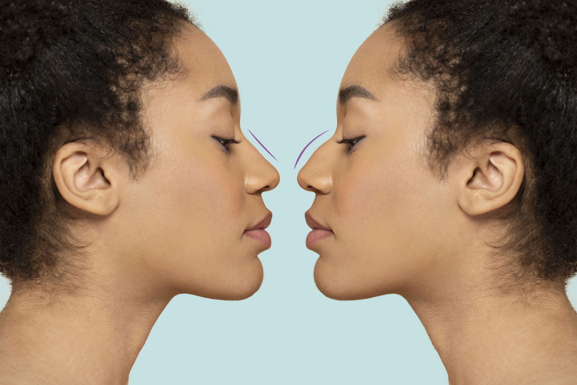 肉毒桿菌注射是否安全？有哪些副作用？